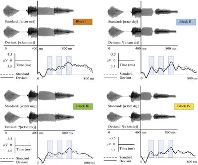 Phonological Variations Are Compensated at the Lexical Level: Evidence From Auditory Neural Activity